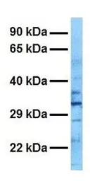 Anti-RALY antibody, N-term used in Western Blot (WB). GTX47714