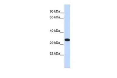 Anti-KIF25 antibody, N-term used in Western Blot (WB). GTX47717