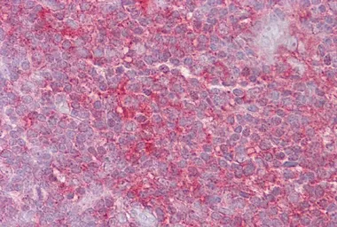 Anti-KIF2A antibody, N-term used in IHC (Paraffin sections) (IHC-P). GTX47733