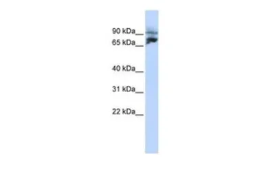 Anti-KIF2A antibody, N-term used in Western Blot (WB). GTX47733