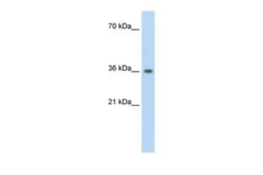 Anti-PHYHIP antibody, N-term used in Western Blot (WB). GTX47736