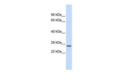 Anti-CTRC antibody, N-term used in Western Blot (WB). GTX47738