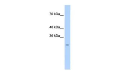 Anti-CTRL antibody, N-term used in Western Blot (WB). GTX47740