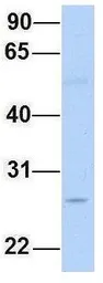 Anti-CTRL antibody, N-term used in Western Blot (WB). GTX47741