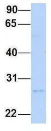 Anti-CTRL antibody, N-term used in Western Blot (WB). GTX47741