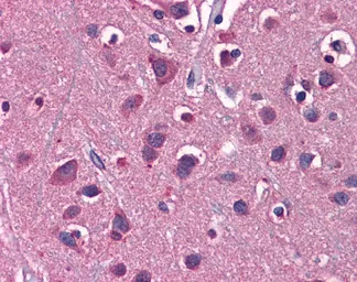 Anti-EAAT2 antibody, N-term used in IHC (Paraffin sections) (IHC-P). GTX47746