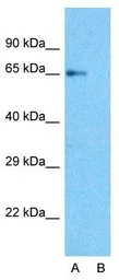 Anti-EAAT2 antibody, N-term used in Western Blot (WB). GTX47746
