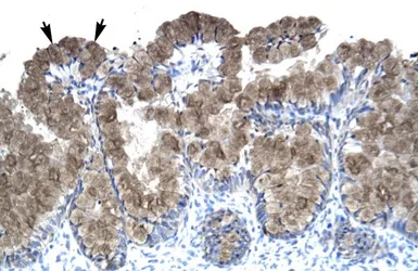 Anti-ASGR2 antibody, N-term used in IHC (Paraffin sections) (IHC-P). GTX47749