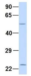 Anti-XK antibody, N-term used in Western Blot (WB). GTX47751