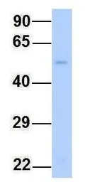 Anti-XK antibody, N-term used in Western Blot (WB). GTX47751