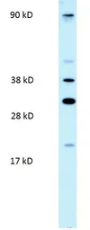 Anti-PARP11 antibody, N-term used in Western Blot (WB). GTX47755