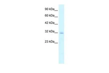 Anti-Claudin 15 antibody, C-term used in Western Blot (WB). GTX47760