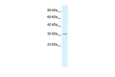 Anti-Claudin 10 antibody, C-term used in Western Blot (WB). GTX47765