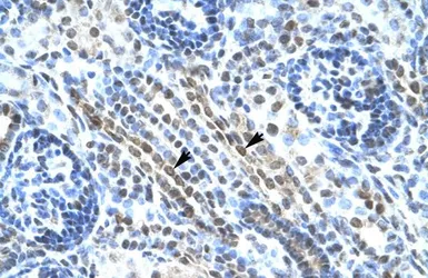 Anti-ANKRD11 antibody, N-term used in IHC (Paraffin sections) (IHC-P). GTX47768