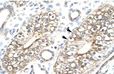 Anti-FLJ11730 antibody, N-term used in IHC (Paraffin sections) (IHC-P). GTX47769