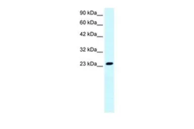 Anti-FLJ11730 antibody, N-term used in Western Blot (WB). GTX47769
