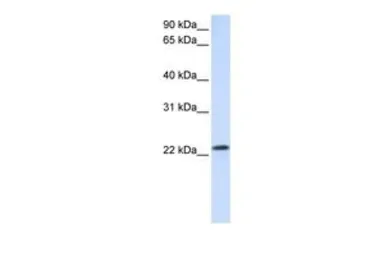 Anti-RAB18 antibody, C-term used in Western Blot (WB). GTX47773