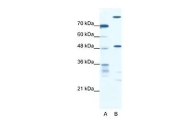 Anti-NFS1 antibody, Internal used in Western Blot (WB). GTX47774