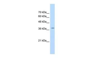 Anti-RALY antibody, C-term used in Western Blot (WB). GTX47776
