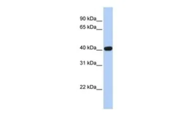 Anti-Coxsackie Adenovirus Receptor antibody, N-term used in Western Blot (WB). GTX47778