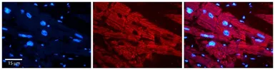 Anti-PCCA antibody, N-term used in IHC (Paraffin sections) (IHC-P). GTX47779