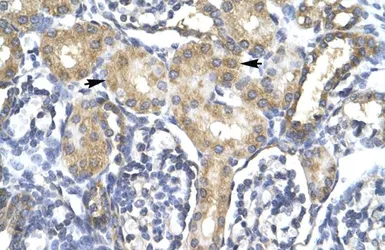 Anti-ACSL1 antibody, C-term used in IHC (Paraffin sections) (IHC-P). GTX47782