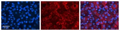Anti-ACSL1 antibody, C-term used in IHC (Paraffin sections) (IHC-P). GTX47782