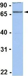 Anti-ACSL1 antibody, C-term used in Western Blot (WB). GTX47782