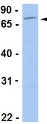 Anti-ACSL1 antibody, C-term used in Western Blot (WB). GTX47782