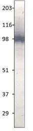 Anti-TLR1 antibody used in Western Blot (WB). GTX47794