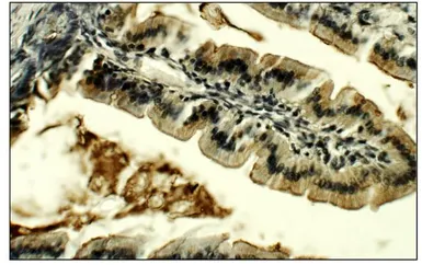 Anti-Lactase antibody used in IHC (Paraffin sections) (IHC-P). GTX47808