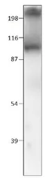Anti-Lactase antibody used in Western Blot (WB). GTX47808