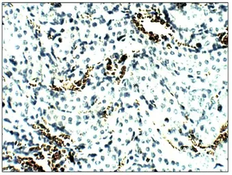 Anti-Aquaporin 8 antibody used in IHC (Paraffin sections) (IHC-P). GTX47812
