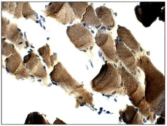 Anti-FBXO32 antibody used in IHC (Paraffin sections) (IHC-P). GTX47819