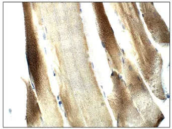Anti-FBXO32 antibody used in IHC (Paraffin sections) (IHC-P). GTX47819