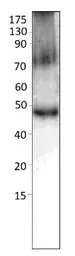 Anti-FBXO32 antibody used in Western Blot (WB). GTX47819