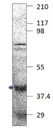 Anti-FBXO32 antibody used in Western Blot (WB). GTX47819