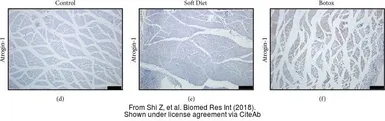 Anti-FBXO32 antibody used in Immunohistochemistry (IHC). GTX47819