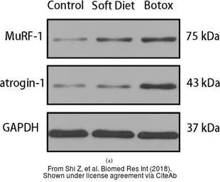 Anti-FBXO32 antibody used in Western Blot (WB). GTX47819