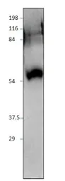 Anti-SIDT1 antibody used in Western Blot (WB). GTX47824
