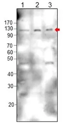 Anti-DCC antibody used in Western Blot (WB). GTX47825