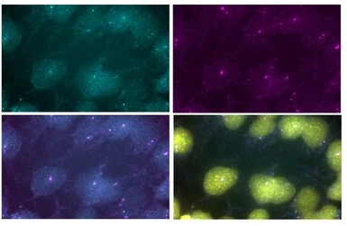 Anti-Usher antibody (C-terminal) used in Immunocytochemistry/ Immunofluorescence (ICC/IF). GTX47843