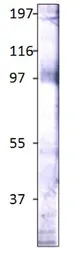 Anti-STRA6 antibody used in Western Blot (WB). GTX47857