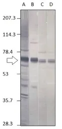 Anti-Punt antibody used in Western Blot (WB). GTX47861