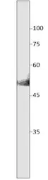 Anti-SLC7A10 antibody (C-terminal) used in Western Blot (WB). GTX47873