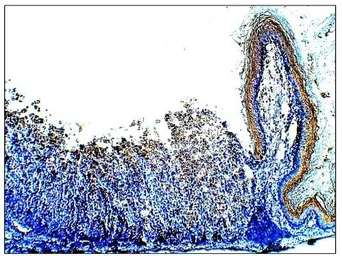 Anti-DEK antibody used in IHC (Paraffin sections) (IHC-P). GTX47896