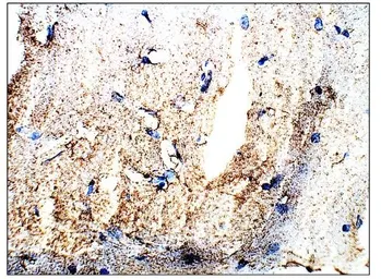 Anti-DEK antibody used in IHC (Paraffin sections) (IHC-P). GTX47896
