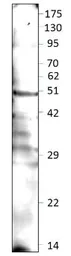 Anti-DEK antibody used in Western Blot (WB). GTX47896