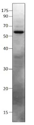 Anti-SHISA9 antibody used in Western Blot (WB). GTX47899