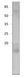 Anti-Cornichon antibody used in Western Blot (WB). GTX47903